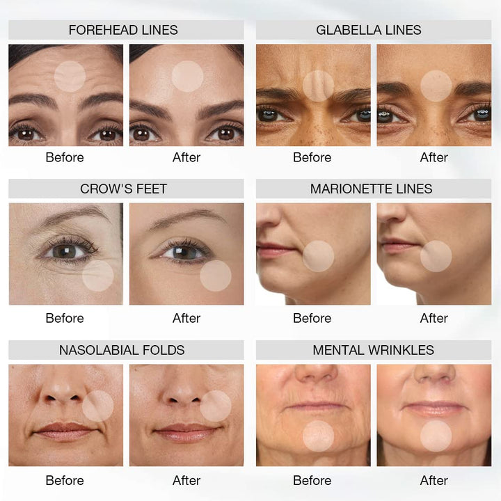 Premium 4 Color LED Light Therapy Mask – Red & Infrared Anti-Aging Silicone Photon Mask, Flexible & Soft Design for Face 