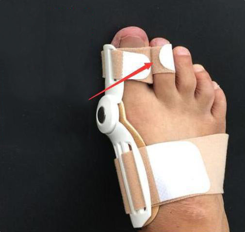 Premium OrthoApedic Bunion Corrector for Hallux Valgus, 2Pcs Adjustable Toe Straightener Splint, Big Toe Alignment & Foot 